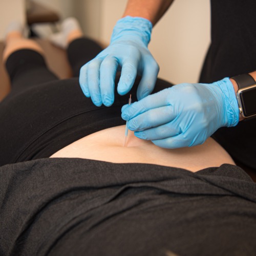 Blue gloves performing dry needling.